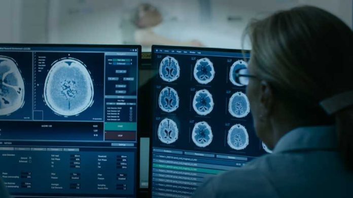 کشف ضایعات مغزی کودکان مبتلا به صرع با کمک هوش مصنوعی