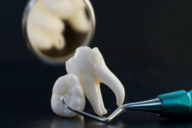 رشد دندان انسانی برای نخستین‌بار در آزمایشگاه