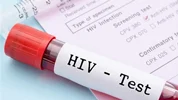 آخرین آمار مبتلایان به HIV در ایران | ۵۰ درصد بیماران شناسایی شدند
